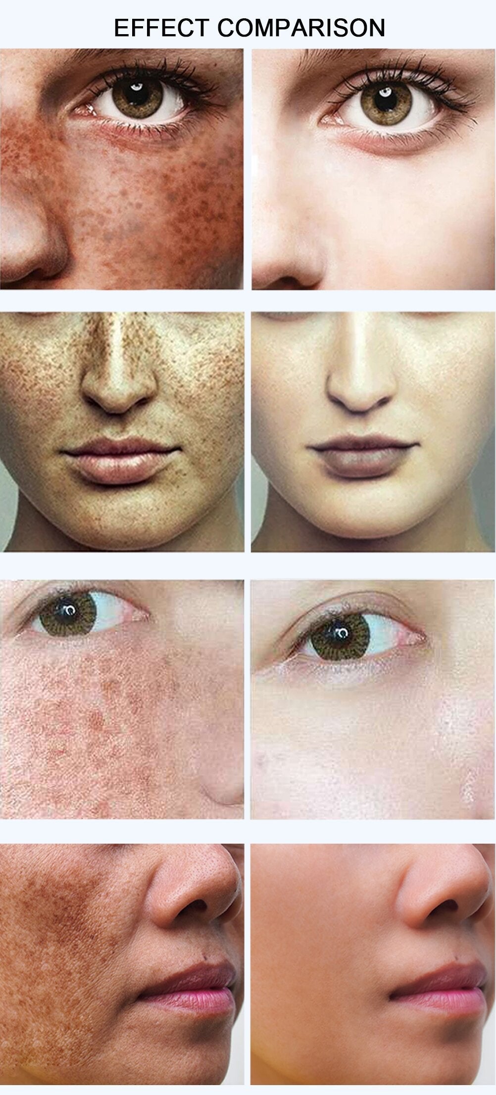 Dark Spots
