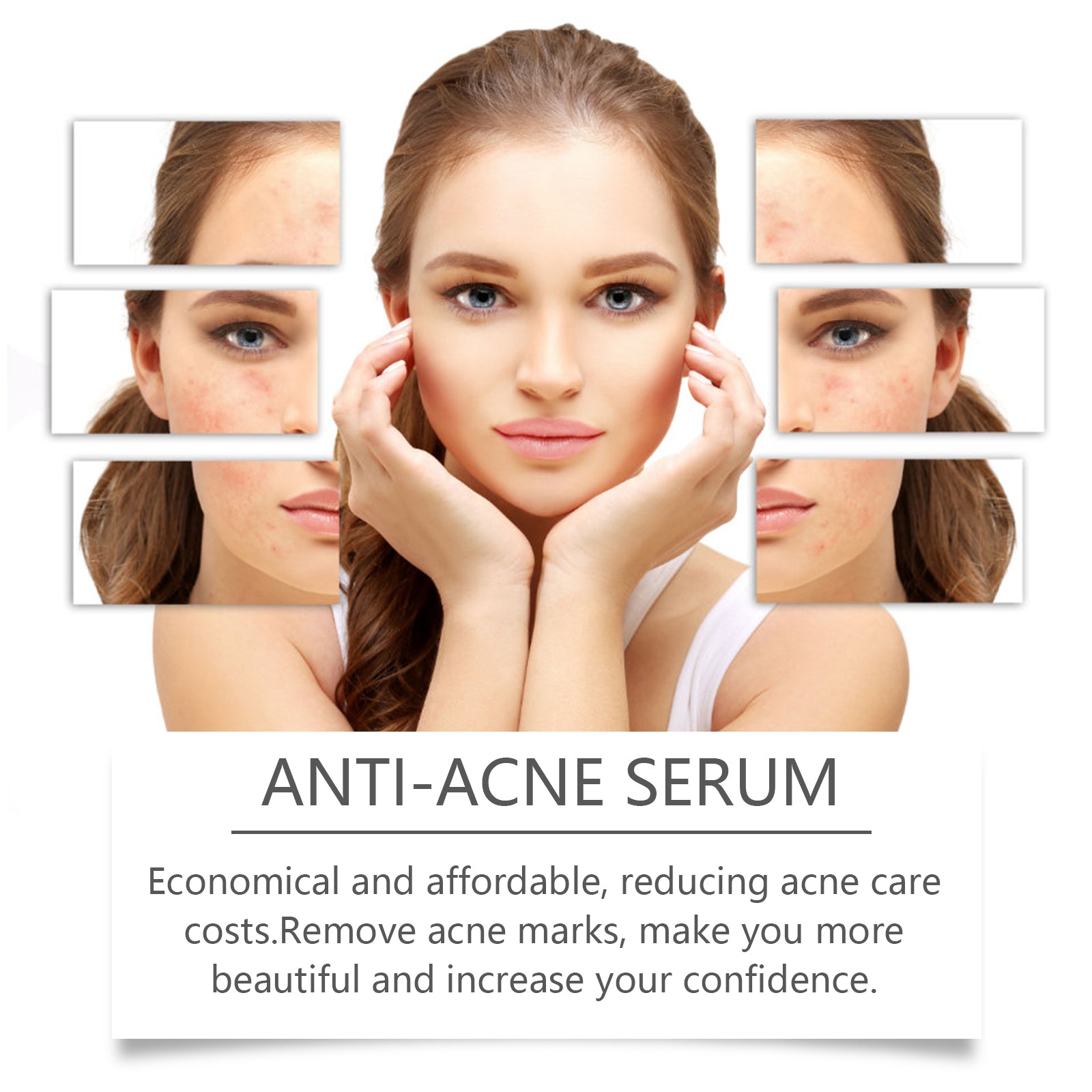 niacin amide anti-acne face serum