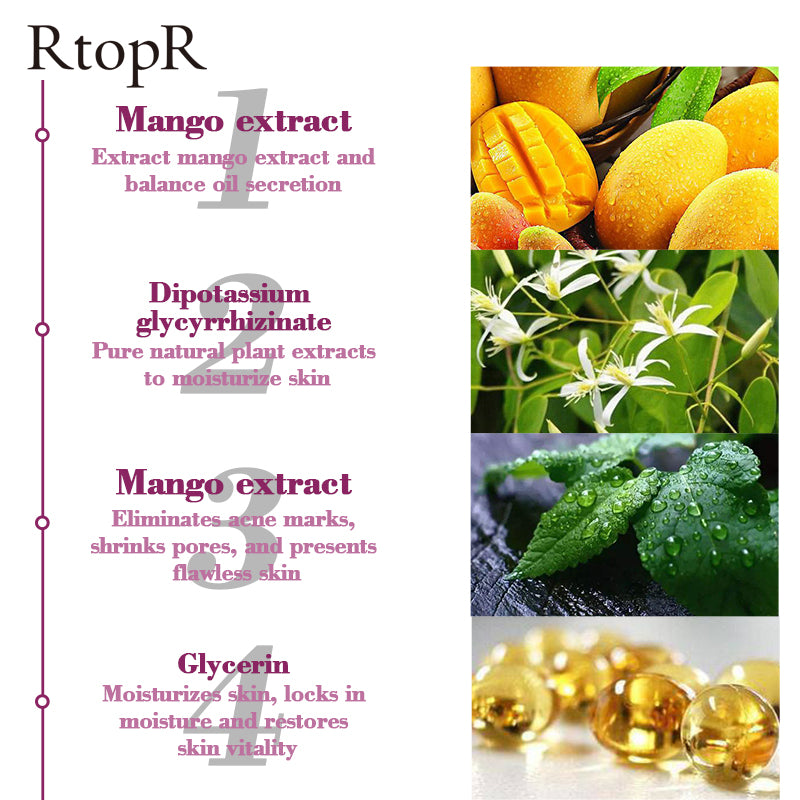 RtopR mango acne cream