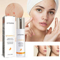 Acne repair face serum