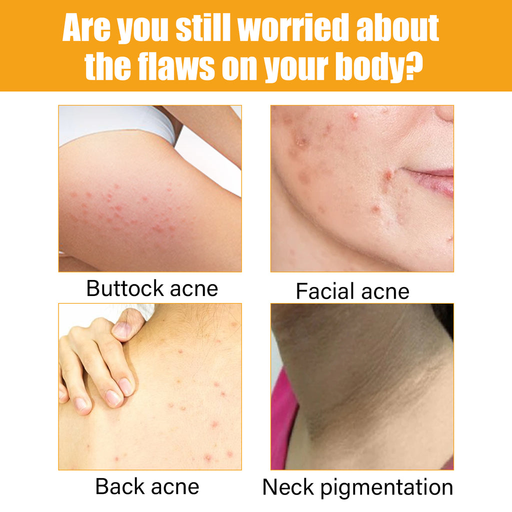 Acne repair face serum